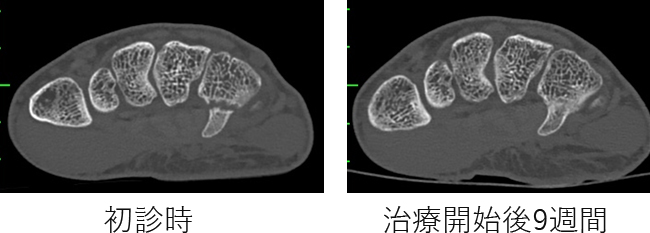 保存的治療