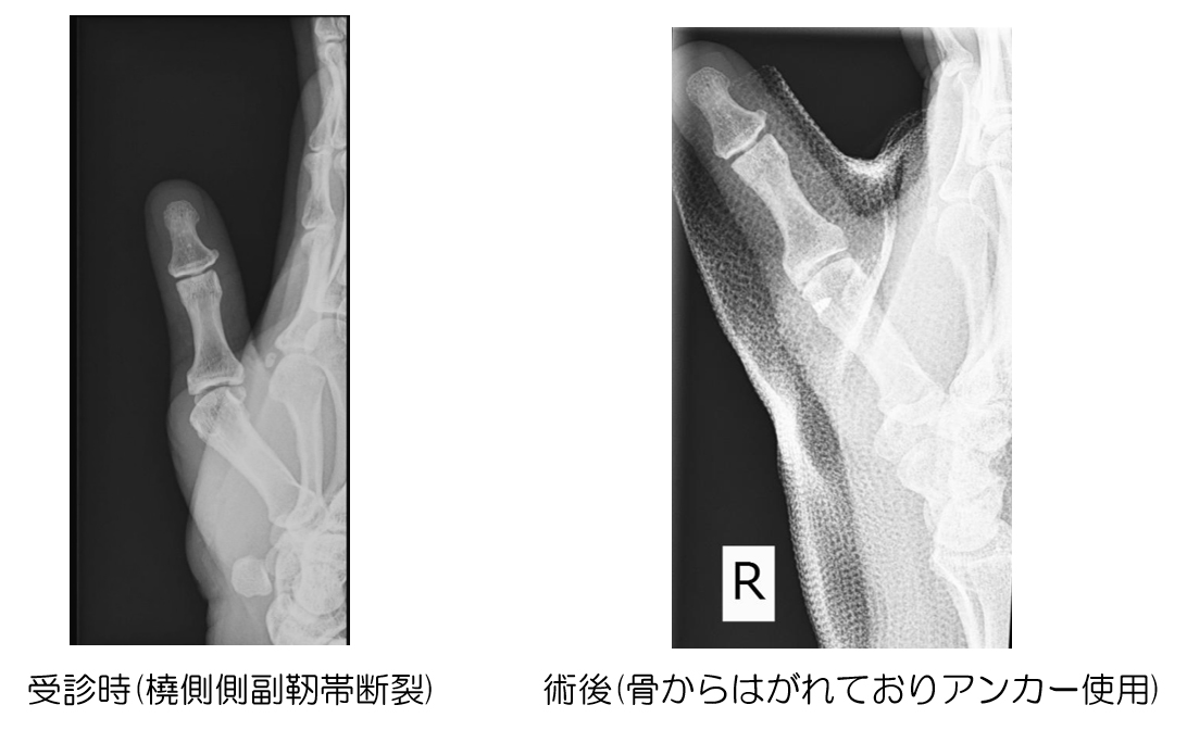 レントゲン画像